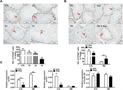 Rapamycin Ameliorates Radiation-Induced Testis Damage in Mice